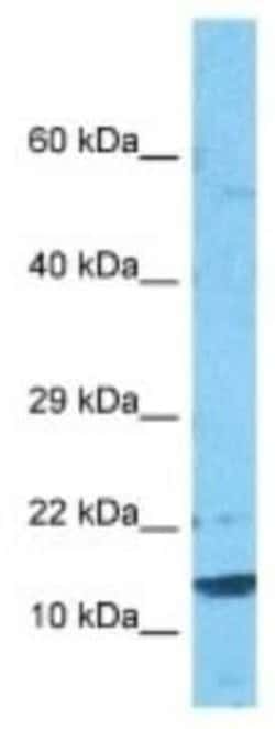 CST9L Rabbit anti-Human, Polyclonal, Novus Biologicals:Antibodies:Primary